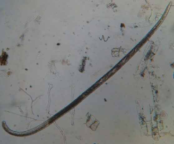 Macho de Meloidogyne spp. formato vermiforme (B). Macho de Meloidogyne spp. formato vermiforme (B).